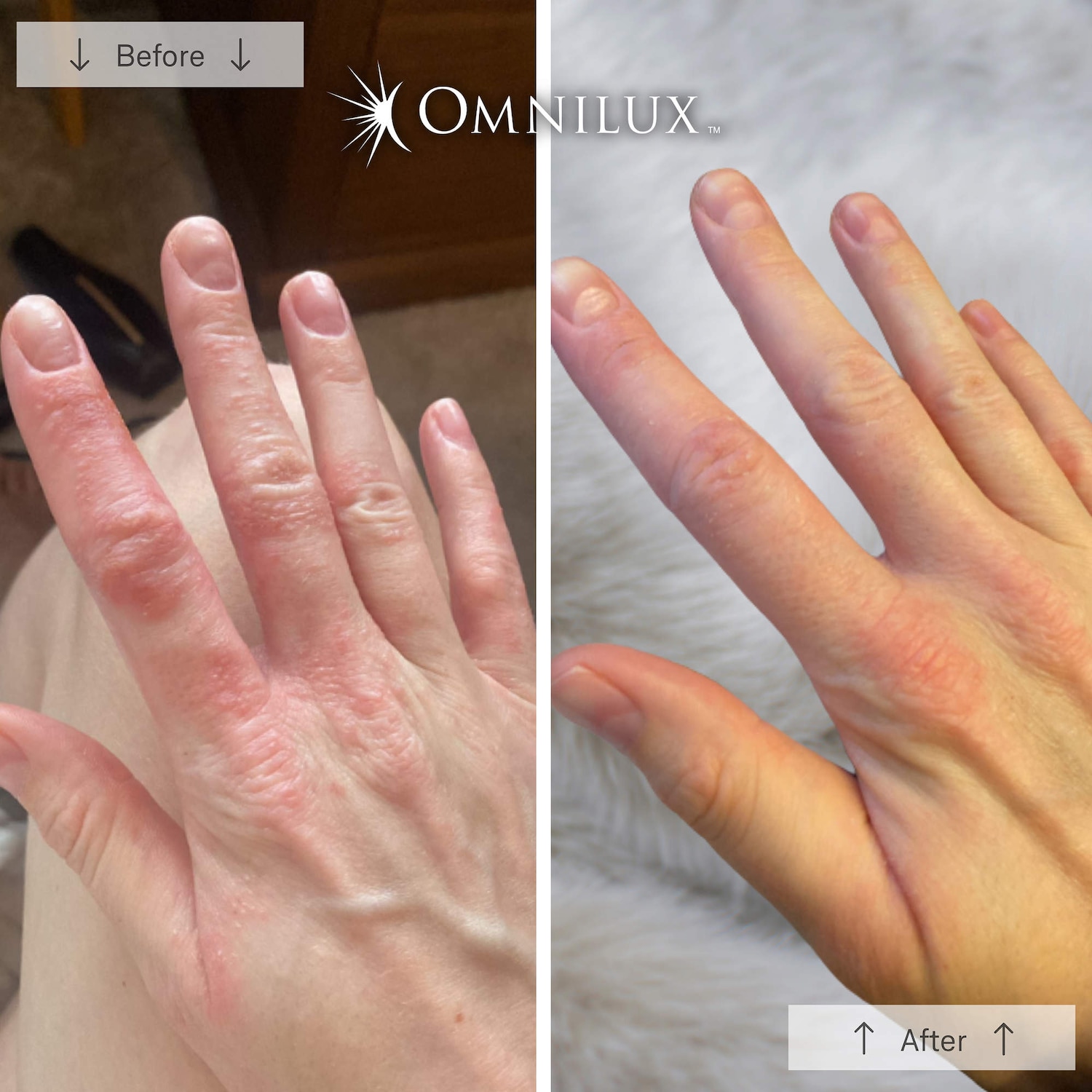 Перчатки Omnilux Contour Glove with Red and Near Infrared Light Therapy LED Device — фото 5