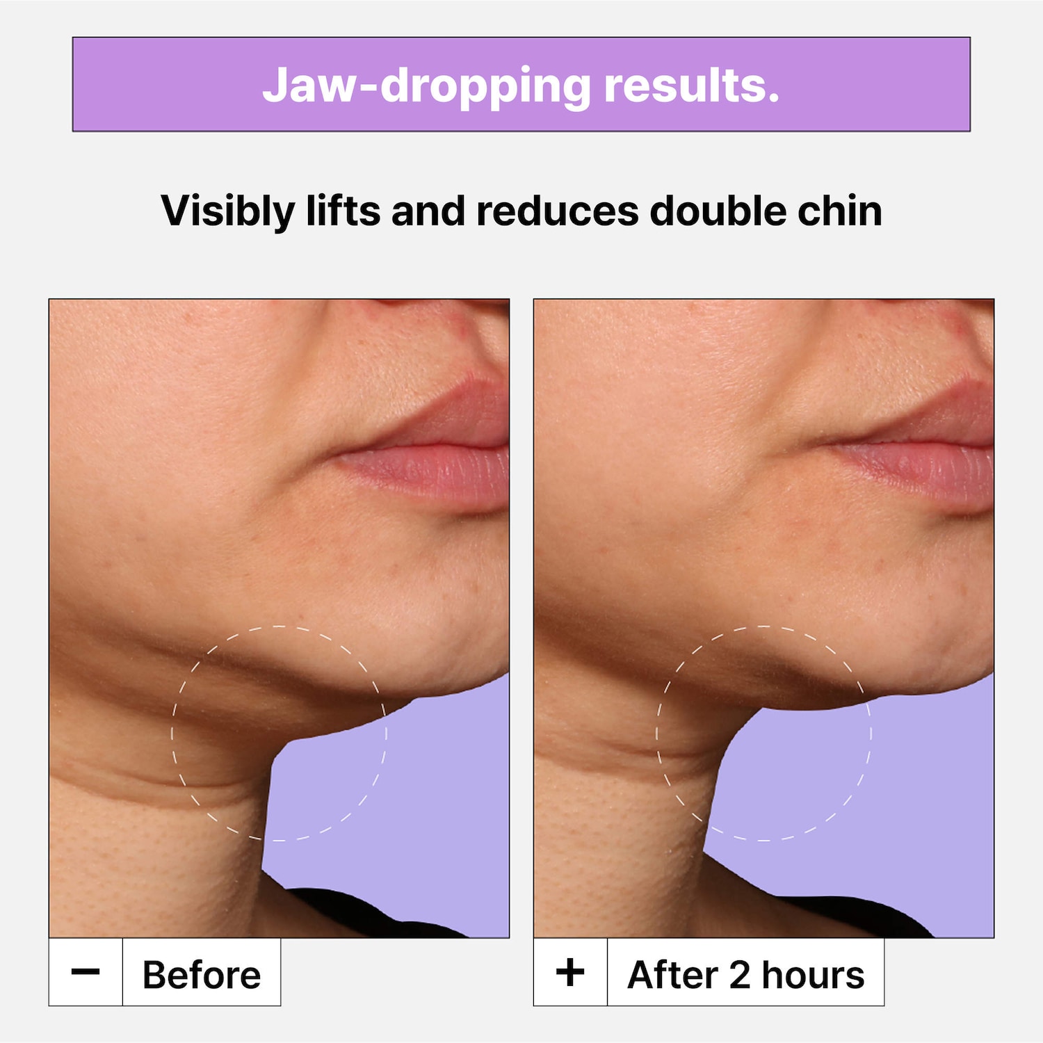 Cryo-V Jawline Lifting Mask with Collagen Peptides - Dr. Jart+