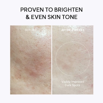 glutathione can cure dark spots Vitamin C Booster Shot Cream with for Brightening Hyperpigmentation and Dullness Contents:60 ml Advanced Mobile IV | dista_id=browntaped:9124842078367