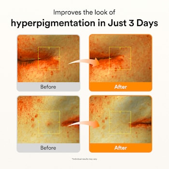 glutathione serum for hyperpigmentation Abib Vitamin C Dark Spot care & Skin Glow 1.69oz/50ml Adding nebulized glutathione to Size:1.69 Oz make sure you use Brands_Designs for Health