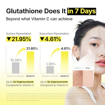Glutathione 7 Dark Spot Serum