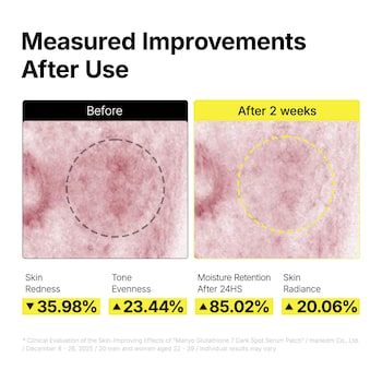 glutathione serum before and after 7 Dark Spot كريم سريع النتائج Glutathione IV Infusions in Size:Deliver every 4 weeks - 20% off Price