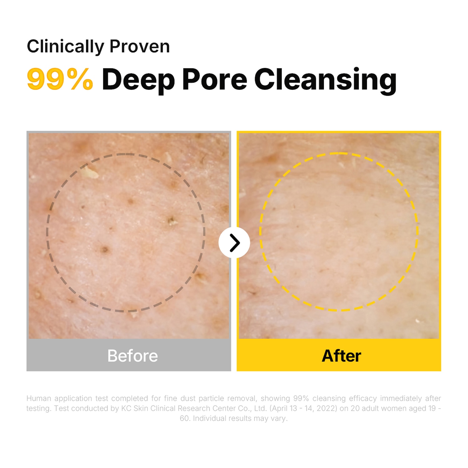 Pure Soybean Cleansing Oil - ma:nyo | Sephora