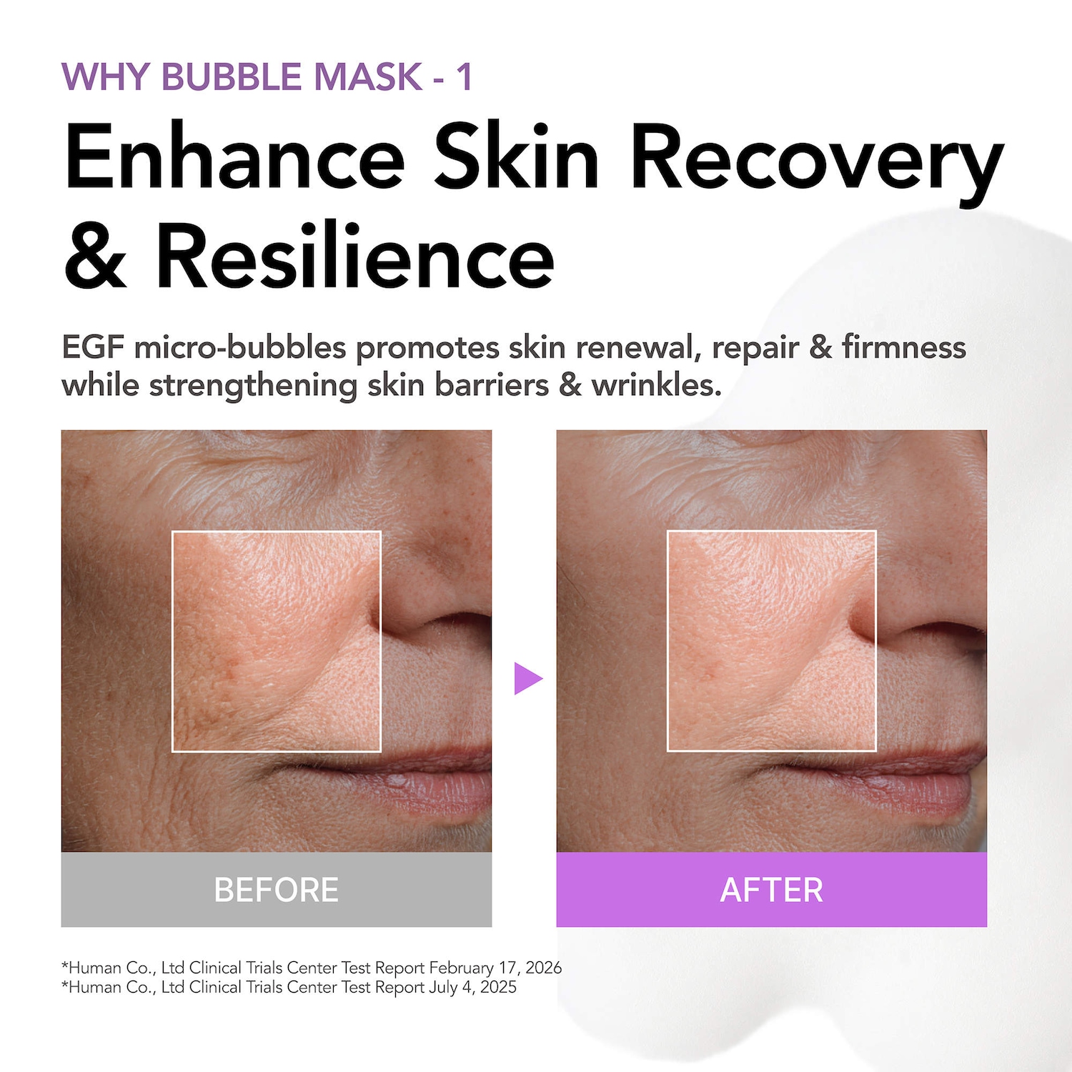 30 sec Quick Bubble Mask - Repair with EGF-Liposome for skin