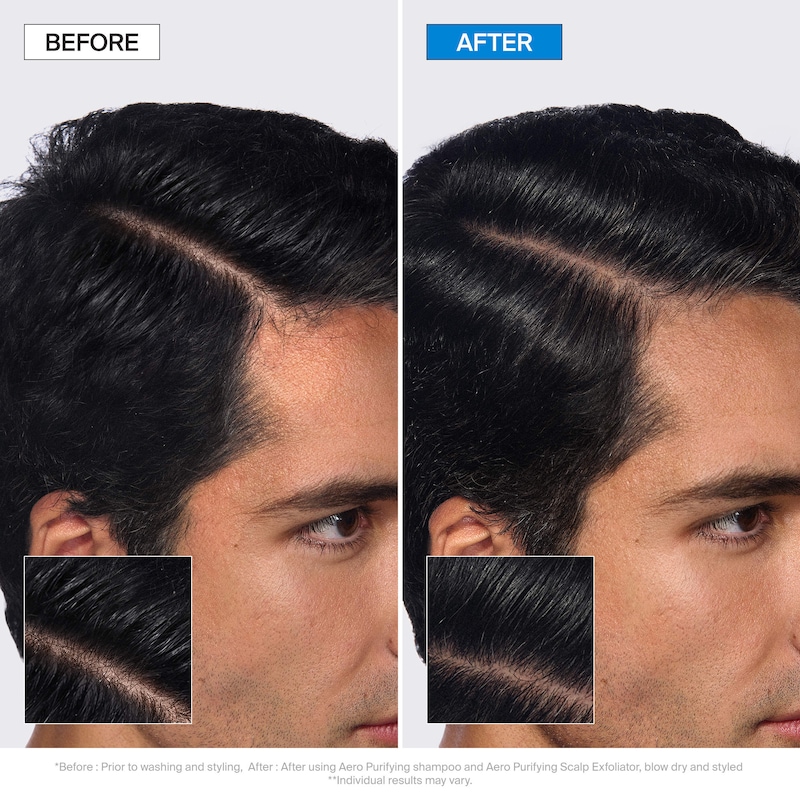 Aero Purifying Scalp Exfoliator for Oily Scalp & Buildup thumbnail 3
