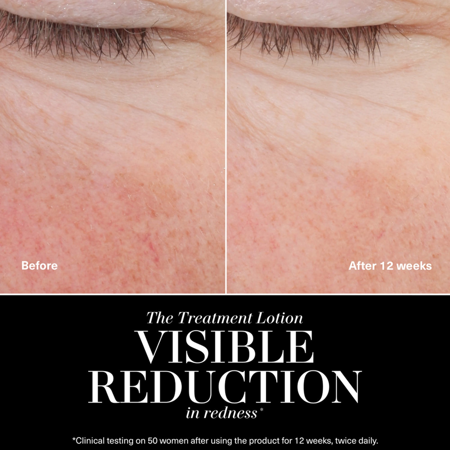 The Treatment Lotion for Hydration and Anti-Aging